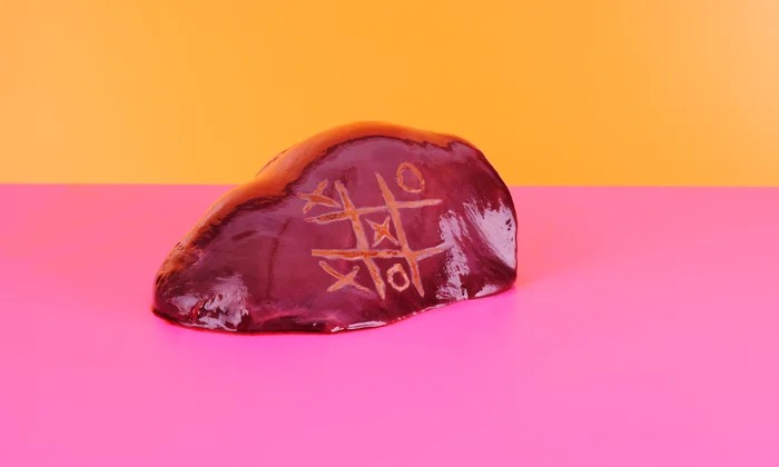 Virškinimo traktas: kaip suprasti, kad kepenys serga?